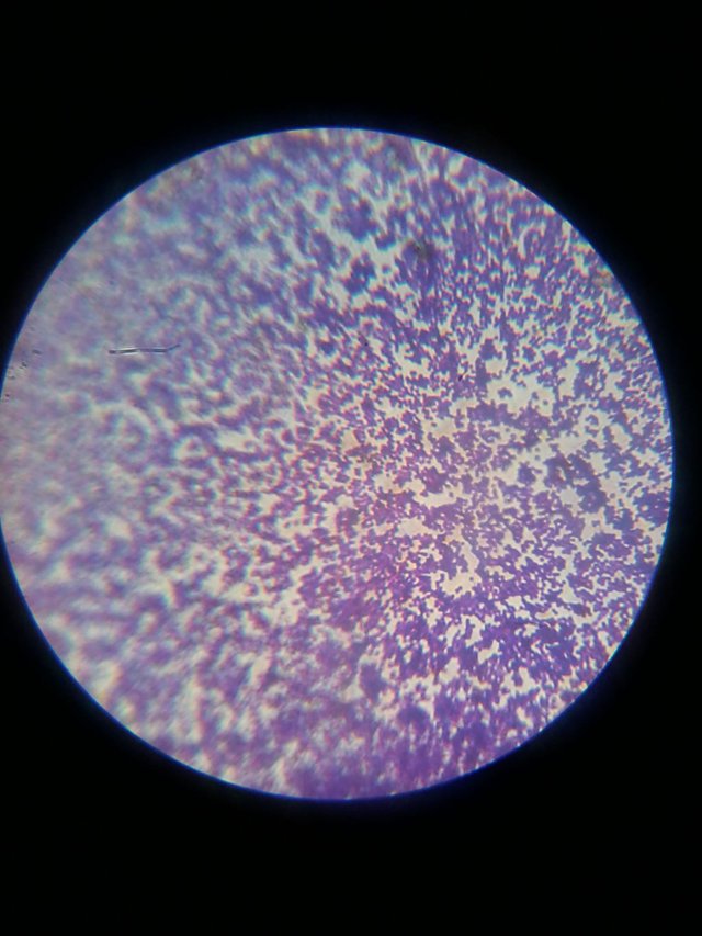 What Does Bacteria Look Like Under Microscope